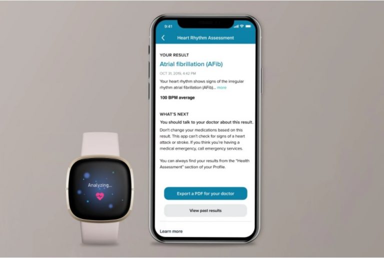 [UPDATE 09.10.20] – Fitbit Sense: ceasul care concurează cu Apple și Samsung prin activarea timpurie a funcției EKG